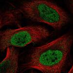 HOXC6 Polyclonal Antibody