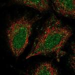 CCDC122 Polyclonal Antibody