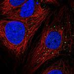 AP1M2 Polyclonal Antibody