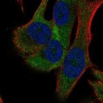 RPS18 Polyclonal Antibody