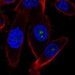 ZNRD1 Polyclonal Antibody