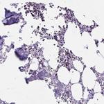 Cytokeratin 27 Polyclonal Antibody