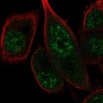 FANCM Polyclonal Antibody