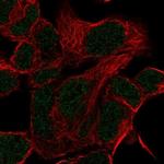 HOXD11 Polyclonal Antibody