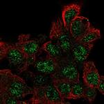 C17orf96 Polyclonal Antibody