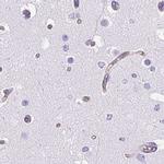 Cytokeratin 12 Antibody in Immunohistochemistry (IHC)