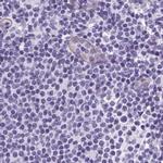 Cytokeratin 12 Antibody in Immunohistochemistry (IHC)