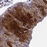 Cytokeratin 12 Polyclonal Antibody