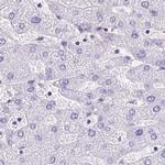 Cytokeratin 12 Antibody in Immunohistochemistry (IHC)