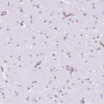 Cytokeratin 12 Antibody in Immunohistochemistry (IHC)