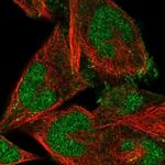 FBXO41 Polyclonal Antibody