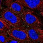 ARVCF Polyclonal Antibody