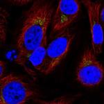 SPCS1 Polyclonal Antibody