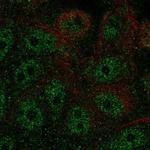 FBP2 Polyclonal Antibody