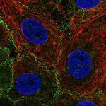 EPS15R Polyclonal Antibody