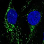 Neuroligin 2 Polyclonal Antibody