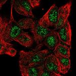 ZNF517 Antibody in Immunocytochemistry (ICC/IF)