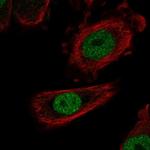 ZHX1 Polyclonal Antibody