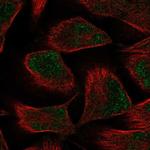 PKNOX2 Polyclonal Antibody