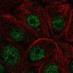 IER2 Polyclonal Antibody