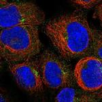 PIDD Polyclonal Antibody