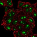 ATPBD4 Polyclonal Antibody