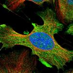 DDX60L Polyclonal Antibody