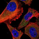 FIR Polyclonal Antibody