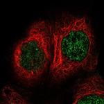 TBRG1 Polyclonal Antibody