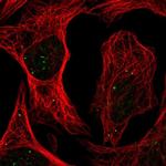 PLAGL1 Polyclonal Antibody