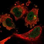 CAND1 Polyclonal Antibody