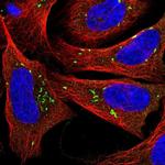 PPAPDC1B Polyclonal Antibody