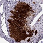 Cytokeratin 12 Polyclonal Antibody