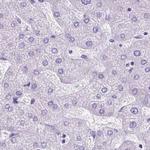 Cytokeratin 12 Antibody in Immunohistochemistry (IHC)