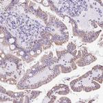 Cytokeratin 12 Antibody in Immunohistochemistry (IHC)
