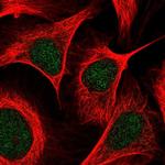 PCAF Polyclonal Antibody