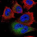 GOLT1B Polyclonal Antibody