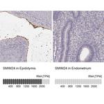 SMIM24 Antibody in Immunohistochemistry (IHC)