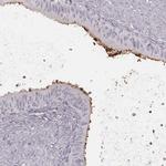 SMIM24 Antibody in Immunohistochemistry (IHC)