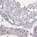 SMIM24 Antibody in Immunohistochemistry (IHC)