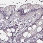 SMIM24 Antibody in Immunohistochemistry (IHC)