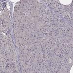 PILRA Antibody in Immunohistochemistry (Paraffin) (IHC (P))