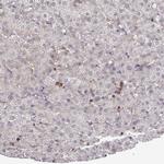 PILRA Antibody in Immunohistochemistry (Paraffin) (IHC (P))