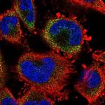 S100A3 Polyclonal Antibody