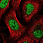 GTF2A2 Polyclonal Antibody