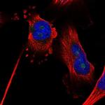 ZNF330 Polyclonal Antibody