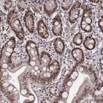 VRK3 Antibody in Immunohistochemistry (Paraffin) (IHC (P))