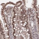 VRK3 Antibody in Immunohistochemistry (IHC)