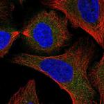 SNAP29 Polyclonal Antibody