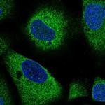 ARHGAP5 Polyclonal Antibody